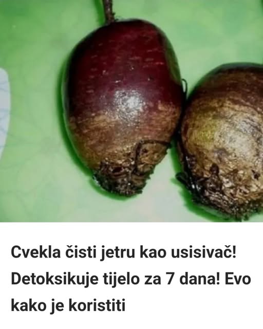Obična cvekla čisti jetru kao usisivač – Ova domaća metoda detoksikuje cijelo tijelo za samo 7 dana! - featured image