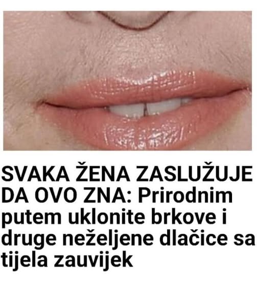 SVAKA ŽENA ZASLUŽUJE DA OVO ZNA: Prirodnim putem uklonite brkove i druge neželjene dlačice sa tijela zauvijek - featured image