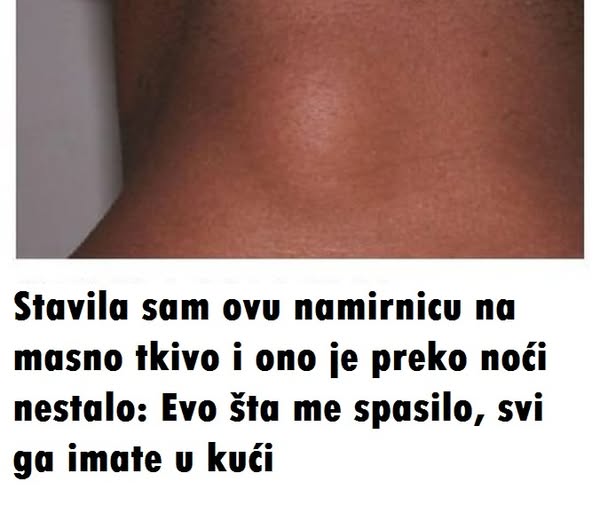 Stavila sam ovu namirnicu na masno tkivo i ono je preko noći nestalo: Evo šta me spasilo, svi ga imate u kući - featured image