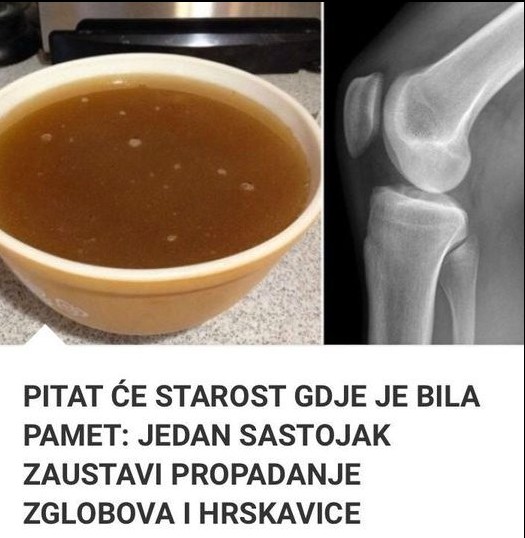 PITAT ĆE STAROST GDJE JE BILA PAMET: JEDAN SASTOJAK ZAUSTAVI PROPADANJE ZGLOBOVA I HRSKAVICE - featured image