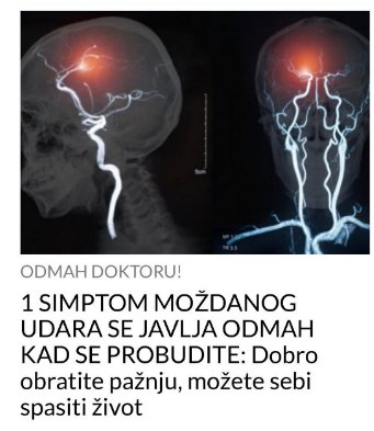 Znakovi koji ukazuju na moždani udar: Evo kako da uradite brzi test koji potvrđuje upozoravajuće simptome - featured image