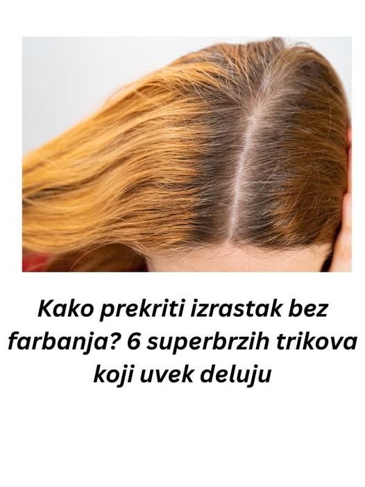 Kako prekriti izrastak bez farbanja? 6 superbrzih trikova koji uvek deluju - featured image