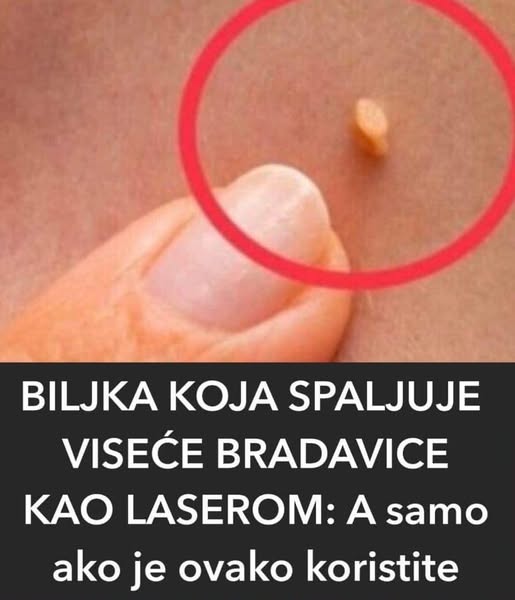 NADALEKO PRIZNATI NARODNI LIJEK ZA LIJEČENJE BRADAVICA JE NITKO DRUGI DO TRAVA RUSA - featured image