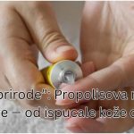 Čudo iz prirode”: Propolisova mast koja liječi sve — od ispucale kože do rane! Čudo iz prirode”: Propolisova mast koja liječi sve — od ispucale kože do rane! - featured image