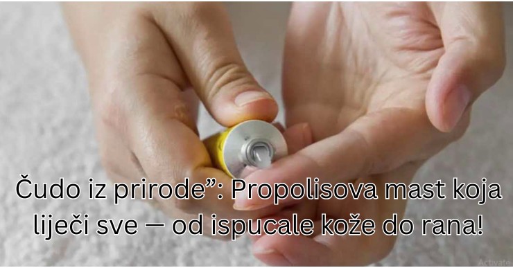 Čudo iz prirode”: Propolisova mast koja liječi sve — od ispucale kože do rane! - featured image Čudo iz prirode”: Propolisova mast koja liječi sve — od ispucale kože do rane! - featured image