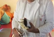 OVI SIMPTOMI UKAZUJU NA ZGRUŠENU KRV U TIJELU: Slijedi VAM SRČANI I MOŽDANI UDAR- U VELIKOJ ste OPASNOSTI OVI SIMPTOMI UKAZUJU NA ZGRUŠENU KRV U TIJELU: Slijedi VAM SRČANI I MOŽDANI UDAR- U VELIKOJ ste OPASNOSTI - featured image