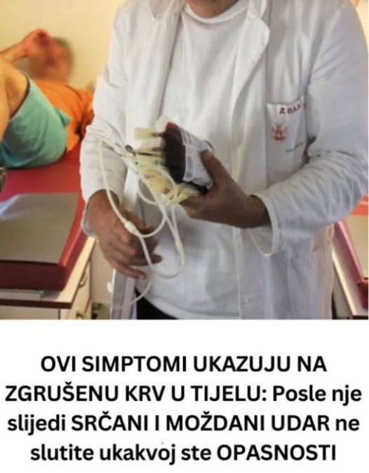 OVI SIMPTOMI UKAZUJU NA ZGRUŠENU KRV U TIJELU: Slijedi VAM SRČANI I MOŽDANI UDAR- U VELIKOJ ste OPASNOSTI - featured image