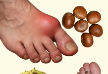 DIVLJI KESTEN – moćan lijek za otečene noge i bolju cirkulaciju DIVLJI KESTEN – moćan lijek za otečene noge i bolju cirkulaciju - featured image