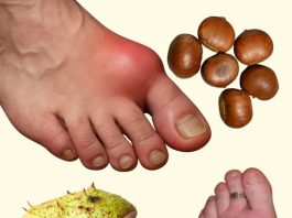 DIVLJI KESTEN – moćan lijek za otečene noge i bolju cirkulaciju DIVLJI KESTEN – moćan lijek za otečene noge i bolju cirkulaciju - featured image