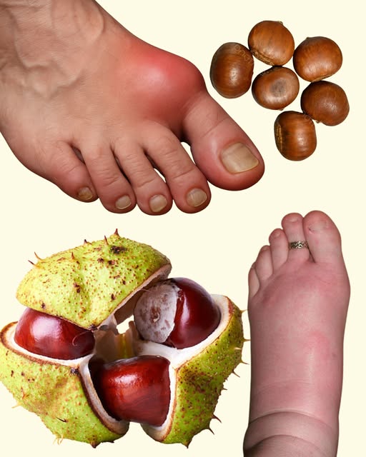 DIVLJI KESTEN – moćan lijek za otečene noge i bolju cirkulaciju - featured image