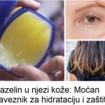 Vazelin u njezinoj koži: Moćan saveznik za hidrataciju i zaštitu Vazelin u njezinoj koži: Moćan saveznik za hidrataciju i zaštitu - featured image