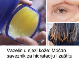 Vazelin u njezinoj koži: Moćan saveznik za hidrataciju i zaštitu Vazelin u njezinoj koži: Moćan saveznik za hidrataciju i zaštitu - featured image
