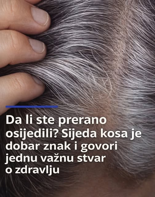 Da li ste prerano osijedili? Sijeda kosa je dobar znak i govori jednu važnu stvar o zdravlju - featured image