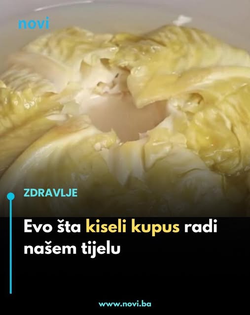 Evo šta kiseli kupus radi našem tijelu - featured image Evo šta kiseli kupus radi našem tijelu - featured image