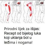 Prirodni lijek za išijas: Recept od bijelog luka koji uklanja bol u leđima i nogama Prirodni lijek za išijas: Recept od bijelog luka koji uklanja bol u leđima i nogama - featured image