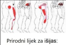 Prirodni lijek za išijas: Recept od bijelog luka koji uklanja bol u leđima i nogama Prirodni lijek za išijas: Recept od bijelog luka koji uklanja bol u leđima i nogama - featured image