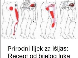 Prirodni lijek za išijas: Recept od bijelog luka koji uklanja bol u leđima i nogama Prirodni lijek za išijas: Recept od bijelog luka koji uklanja bol u leđima i nogama - featured image