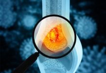 Tihi simptomi raka kostiju: Kakav bol i u kom delu tela može da bude alarm upozorenja Tihi simptomi raka kostiju: Kakav bol i u kom delu tela može da bude alarm upozorenja - featured image