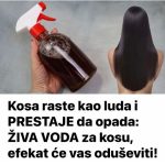 Kosa raste kao luda i PRESTAJE da opada: ŽIVA VODA za kosu, efekat će vas oduševiti! Kosa raste kao luda i PRESTAJE da opada: ŽIVA VODA za kosu, efekat će vas oduševiti! - featured image
