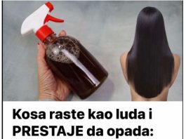 Kosa raste kao luda i PRESTAJE da opada: ŽIVA VODA za kosu, efekat će vas oduševiti! Kosa raste kao luda i PRESTAJE da opada: ŽIVA VODA za kosu, efekat će vas oduševiti! - featured image