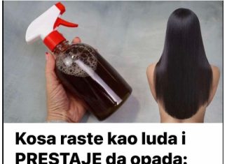 Kosa raste kao luda i PRESTAJE da opada: ŽIVA VODA za kosu, efekat će vas oduševiti! Kosa raste kao luda i PRESTAJE da opada: ŽIVA VODA za kosu, efekat će vas oduševiti! - featured image
