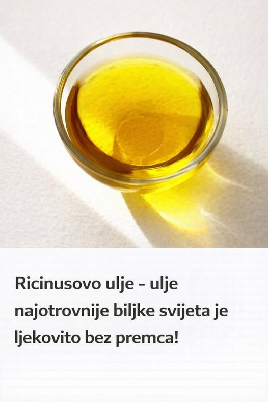 Ricinusovo ulje – ulje najotrovnije biljke svijeta je ljekovito bez premca! - featured image