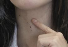 ŠTITNA ŽLIJEZDA SE PREPORODI ZA NEKOLIKO NEDJELJA: Dovedite hormone u red prirodnim sredstvima ŠTITNA ŽLIJEZDA SE PREPORODI ZA NEKOLIKO NEDJELJA: Dovedite hormone u red prirodnim sredstvima - featured image