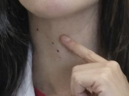 ŠTITNA ŽLIJEZDA SE PREPORODI ZA NEKOLIKO NEDJELJA: Dovedite hormone u red prirodnim sredstvima ŠTITNA ŽLIJEZDA SE PREPORODI ZA NEKOLIKO NEDJELJA: Dovedite hormone u red prirodnim sredstvima - featured image