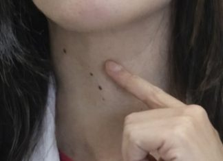 ŠTITNA ŽLIJEZDA SE PREPORODI ZA NEKOLIKO NEDJELJA: Dovedite hormone u red prirodnim sredstvima ŠTITNA ŽLIJEZDA SE PREPORODI ZA NEKOLIKO NEDJELJA: Dovedite hormone u red prirodnim sredstvima - featured image