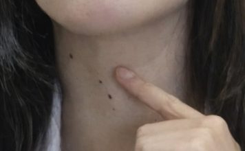 ŠTITNA ŽLIJEZDA SE PREPORODI ZA NEKOLIKO NEDJELJA: Dovedite hormone u red prirodnim sredstvima ŠTITNA ŽLIJEZDA SE PREPORODI ZA NEKOLIKO NEDJELJA: Dovedite hormone u red prirodnim sredstvima - featured image