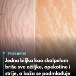 Jedna biljka kao skalpelom briše sve ožiljke, opekotine i strije, a koža se podmlađuje Jedna biljka kao skalpelom briše sve ožiljke, opekotine i strije, a koža se podmlađuje - featured image