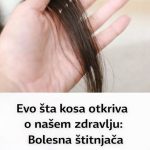 Evo šta kosa otkriva o našem zdravlju: Bolesna štitnjača ili anemija… Evo šta kosa otkriva o našem zdravlju: Bolesna štitnjača ili anemija… - featured image