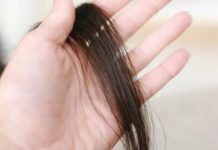 Evo šta kosa otkriva o našem zdravlju: Bolesna štitnjača ili anemija… Evo šta kosa otkriva o našem zdravlju: Bolesna štitnjača ili anemija… - featured image