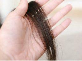 Evo šta kosa otkriva o našem zdravlju: Bolesna štitnjača ili anemija… Evo šta kosa otkriva o našem zdravlju: Bolesna štitnjača ili anemija… - featured image