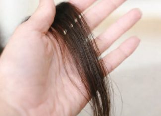 Evo šta kosa otkriva o našem zdravlju: Bolesna štitnjača ili anemija… Evo šta kosa otkriva o našem zdravlju: Bolesna štitnjača ili anemija… - featured image