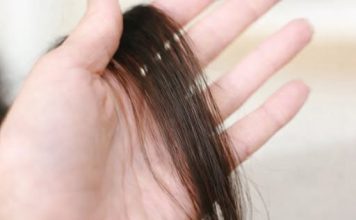 Evo šta kosa otkriva o našem zdravlju: Bolesna štitnjača ili anemija… Evo šta kosa otkriva o našem zdravlju: Bolesna štitnjača ili anemija… - featured image