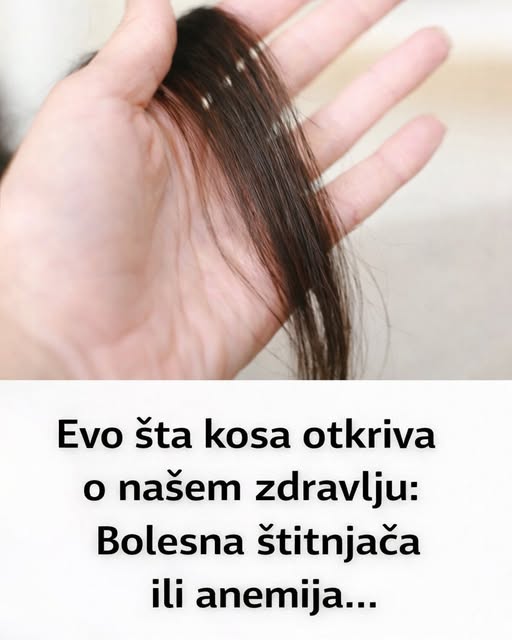 Evo šta kosa otkriva o našem zdravlju: Bolesna štitnjača ili anemija… - featured image