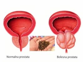 Spas za muškarce: Riješite probleme prostate na prirodan način! Spas za muškarce: Riješite probleme prostate na prirodan način! - featured image