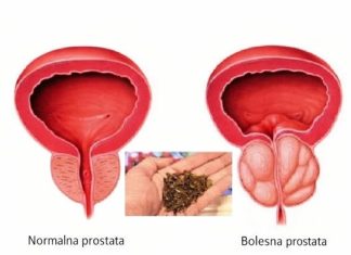 Spas za muškarce: Riješite probleme prostate na prirodan način! Spas za muškarce: Riješite probleme prostate na prirodan način! - featured image