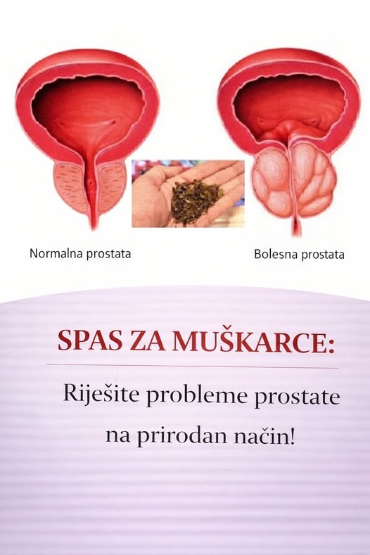 Spas za muškarce: Riješite probleme prostate na prirodan način! - featured image
