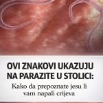 OVI ZNAKOVI UKAZUJU NA PARAZITE U STOLICI: Kako da prepoznate jesu li vam napali crijeva OVI ZNAKOVI UKAZUJU NA PARAZITE U STOLICI: Kako da prepoznate jesu li vam napali crijeva - featured image