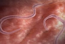 OVI ZNAKOVI UKAZUJU NA PARAZITE U STOLICI: Kako da prepoznate jesu li vam napali crijeva OVI ZNAKOVI UKAZUJU NA PARAZITE U STOLICI: Kako da prepoznate jesu li vam napali crijeva - featured image