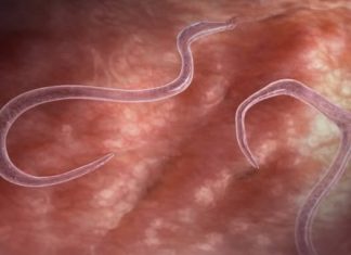 OVI ZNAKOVI UKAZUJU NA PARAZITE U STOLICI: Kako da prepoznate jesu li vam napali crijeva OVI ZNAKOVI UKAZUJU NA PARAZITE U STOLICI: Kako da prepoznate jesu li vam napali crijeva - featured image