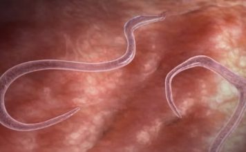 OVI ZNAKOVI UKAZUJU NA PARAZITE U STOLICI: Kako da prepoznate jesu li vam napali crijeva OVI ZNAKOVI UKAZUJU NA PARAZITE U STOLICI: Kako da prepoznate jesu li vam napali crijeva - featured image