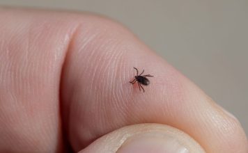 Ova stvar na čarapi najbolje tjera krpelje