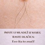 IMATE LI MLADEŽ IZ KOJEG RASTE DLAČICA: Evo šta to znači! Važno da znate IMATE LI MLADEŽ IZ KOJEG RASTE DLAČICA: Evo šta to znači! Važno da znate - featured image