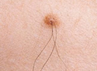 IMATE LI MLADEŽ IZ KOJEG RASTE DLAČICA: Evo šta to znači! Važno da znate IMATE LI MLADEŽ IZ KOJEG RASTE DLAČICA: Evo šta to znači! Važno da znate - featured image