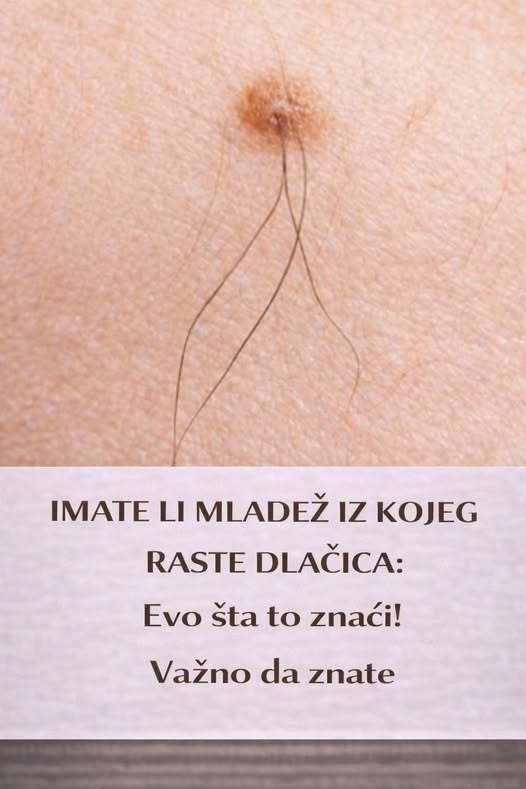 IMATE LI MLADEŽ IZ KOJEG RASTE DLAČICA: Evo šta to znači! Važno da znate - featured image