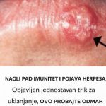 NAGLI PAD IMUNITET I POJAVA HERPESA: Objavljen jednostavan trik za uklanjanje, OVO PROBAJTE ODMAH NAGLI PAD IMUNITET I POJAVA HERPESA: Objavljen jednostavan trik za uklanjanje, OVO PROBAJTE ODMAH - featured image