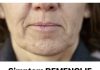 Simptom DEMENCIJE koji se javlja u ustima: Ako ga osjetite, obratite se ljekaru Simptom DEMENCIJE koji se javlja u ustima: Ako ga osjetite, obratite se ljekaru - featured image
